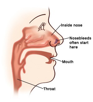 how to stop nose bleeding