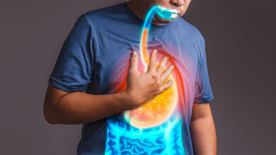 heartburn remedy